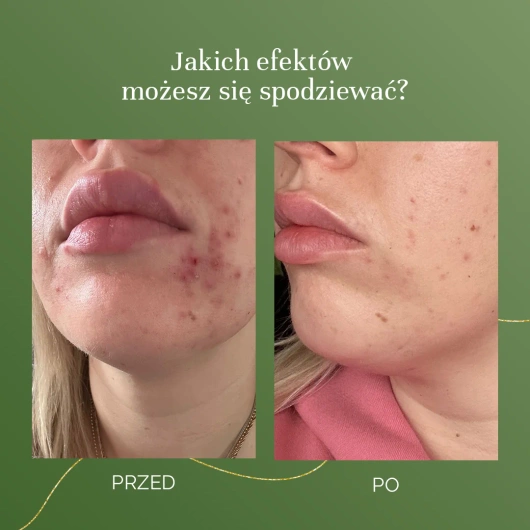 MyBestComplement Olej, 250 ml DATA WAŻNOŚCI 31/12/2025