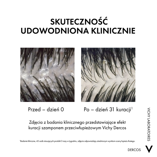 Vichy Dercos DS Szampon przeciw łupieżowy 2w1, 390ml