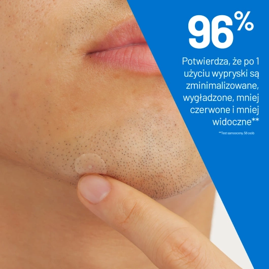 CeraVe Punktowe Plasterki na Wypryski, 22 plasterki