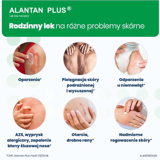 ALANTAN PLUS (20 mg + 50 mg)/ g maść 30 g
