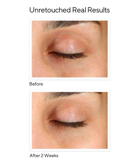 MURAD Environmental Shield Vita-C Eyes Dark Circle Corrector, 15 ml