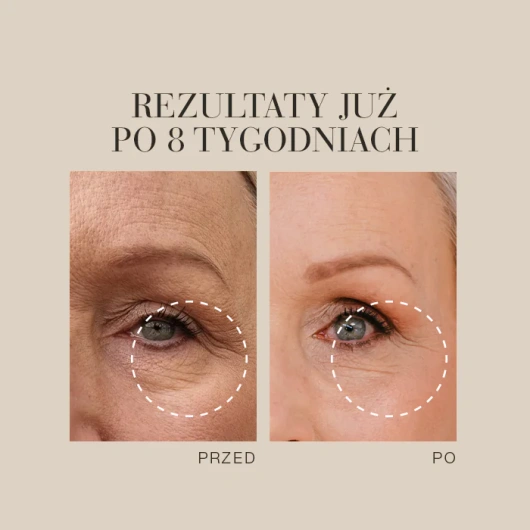 New Nordic Natural Magic Amazing Eye Cream Krem pod oczy, 15 ml