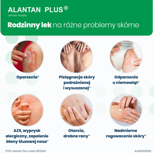 Alantan Plus Maść (20mg+50mg)/g, 100 g
