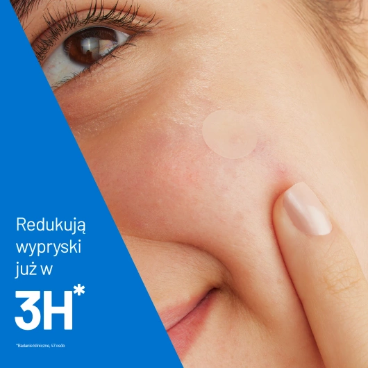 CeraVe Punktowe Plasterki na Wypryski, 22 plasterki