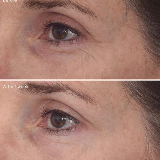 MURAD RETINAL kuracja do okolic oczu, 15ml