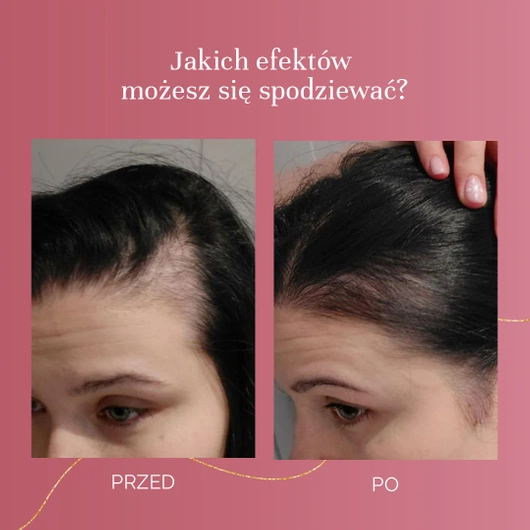 MyBestBeauty, 90 kapsułek