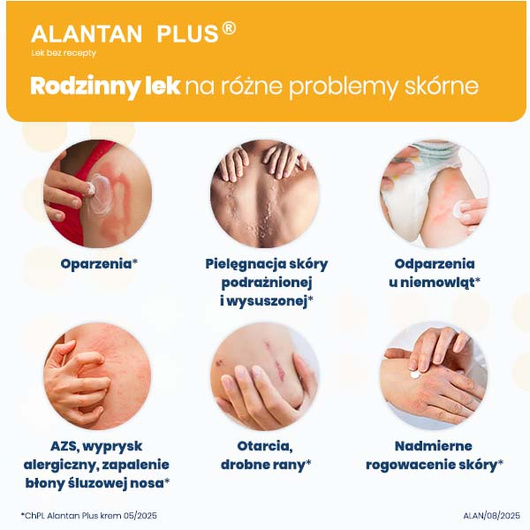 ALANTAN PLUS (20 mg + 50 mg)/g, krem 35 g