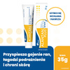 ALANTAN PLUS (20 mg + 50 mg)/g, krem 35 g