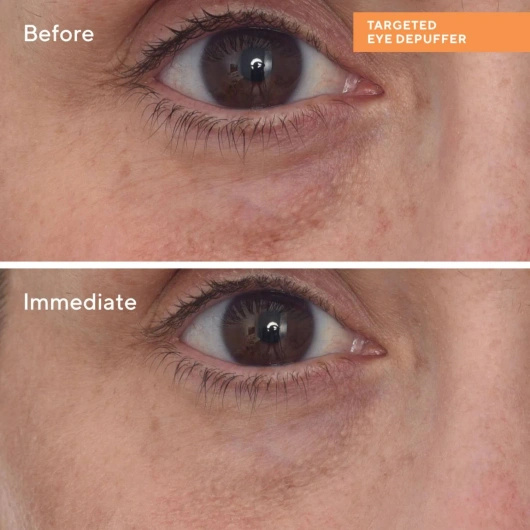 MURAD Environmental Shield Targeted Eye Depuffer, 15ml