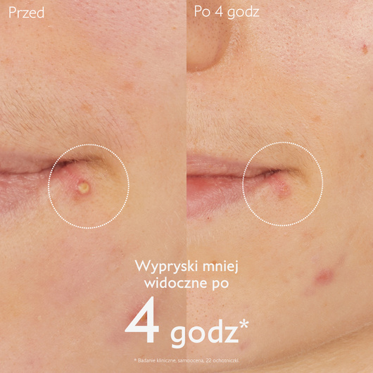 Caudalie Vinopure Punktowa kuracja z kwasem salicylowym, 15 ml