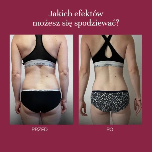 MyBestSkinny Proszek wspomagający odchudzanie, 222 g